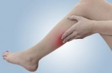 Жировик на нозі: стегнах, сідницях, стегнах: причини, як прибрати. Лікування ліпоми на нозі