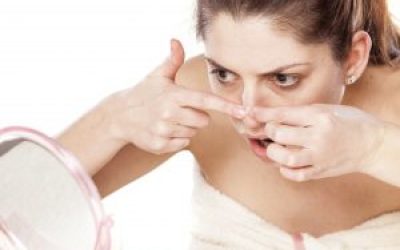 Прищі на носі у жінок і чоловіків: причини, лікування. Як позбутися від вугрів на носі (крилах носа)