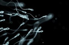 Патологічні форми сперматозоїдів: причини, лікування
