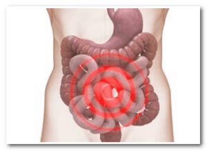 Лікування грибка в шлунку – причини і симптоми