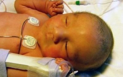Білірубін у новонароджених: який повинен бути рівень в нормі, лікування