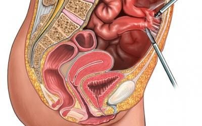 Закид жовчі в шлунок: симптоми, причини виникнення, методи лікування
