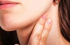 Жировик на шиї: причини, як позбутися. Лікування ліпоми на шиї ззаду