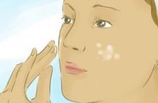 Чорні прищі на обличчі: причини, лікування, як швидко позбутися від чорних вугрів