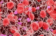 Норма тромбоцитів в крові у чоловіків: підвищення, пониження