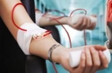 Переливання крові від прищів – опис та ефективність процедури