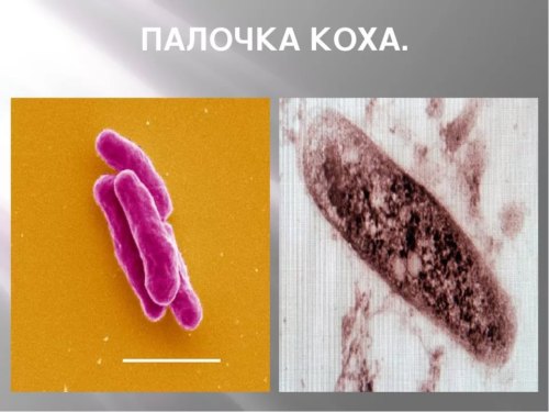 Туберкульоз шкіри: причини та шляхи зараження, симптоми, діагностика