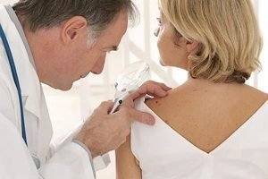 ВПЛ 16 типу у жінок: діагностика папіломавірусу, симптоми і чи можна вилікувати