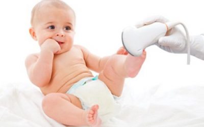 Балія нирки розширена у дитини: піелоектазія у новонародженого