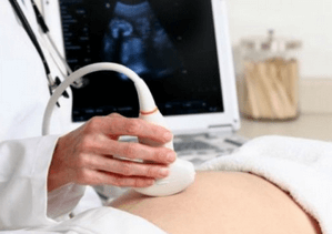 Ретрохориальная гематома при вагітності