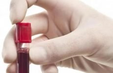 Норма еритроцитів в крові у чоловіків: за віком, осідання