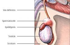 Пухлина сечового міхура у чоловіків: причини, симптоми, лікування
