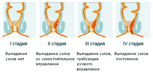 92a8ef40304b990f1fff530e4efdfd6e