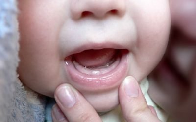 Що робити, якщо у дитини прорізуються зуби і з’явився запор