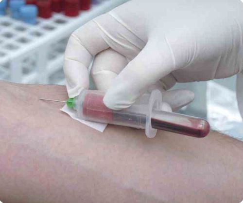 Аналіз крові при панкреатиті, показники крові при біохімічному аналізі