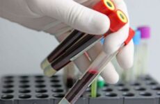 Біохімічний аналіз крові при цирозі печінки: показники, результати