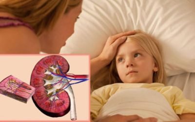 Запалення нирок у дитини: симптоми і лікування у дітей запалення нирки