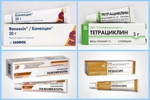 Антибіотики при фурункульозі в паху і на обличчі: тетрацикліни, Цефтріаксон, Амоксиклав і інші препарати