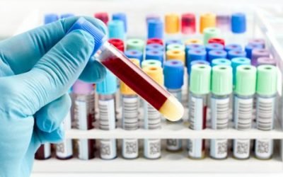 Аналіз крові: наявність сечовини в аналізі — що це значить