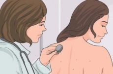 Прищі на спині і плечах: причини, лікування, як позбутися (вилікувати)