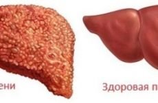 Симптоми і ознаки захворювань печінки: де знаходиться і як болить печінка у людини