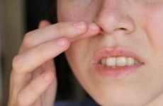 Внутрішній прищ на носі: причини і лікування. Як лікувати внутрішні прищі в носі