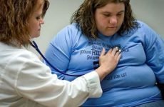 Бандажування шлунка, відгуки про шлункових бандажах для схуднення