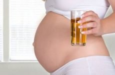 Аналіз сечі по Нечипоренко — як збирати сечу вагітним