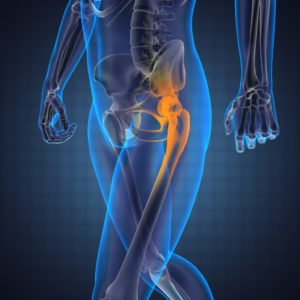 Болить нога в тазостегновому суглобі при ходьбі: лікування в домашніх умовах і симптоми