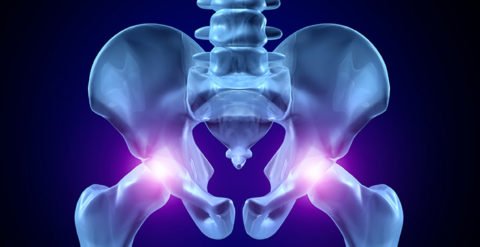 Закритий перелом стегна: види, симптоми, причини, методи діагностики та лікування