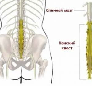 3 кращих методу діагностики поперекового остеохондрозу 45 05562fddab304f7900a56766d76cd1cb