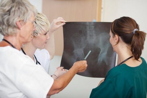 Як лікувати перелом: рекомендації по швидкому зрощенню кісток