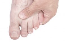 Перелом мізинця на нозі зі зміщенням: причини, симптоми, лікування
