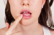 Жировики на губах: причини виникнення та основні методи терапії