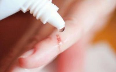 Антисептик для ран (спрей і порошок): перелік назв, обробка поранень антисептиками в домашніх умовах