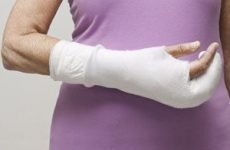 Перелом кисті руки із зміщенням і без: лікування і як розробити руку після травми
