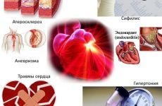 Аортальний порок серця: що це таке, симптоми і лікування