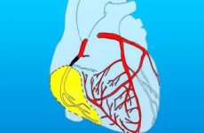 Прогноз, наслідки та лікування інфаркту задньої стінки серця