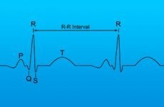 Що означає зниження варіабельності серцевого ритму