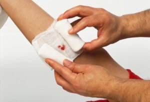 Перевязка гнійної рани: алгоритм, набір інструментів для проведення процедури перевязки рани