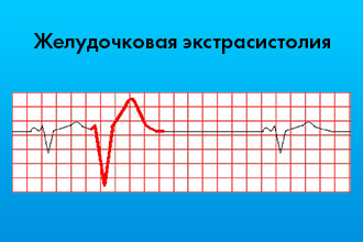 2de471b50c515283976cf279c6086ddd