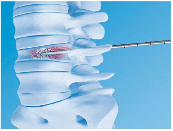 3626b0a720b76e9325a789152401a1b6