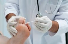 Який лікар лікує грибок нігтів на ногах: міколог або дерматолог?