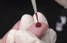 Значення аналізу крові на гельмінти