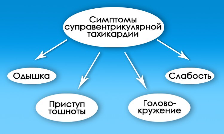 3c3c8e2eb50b988a1614eafdd9433e2c