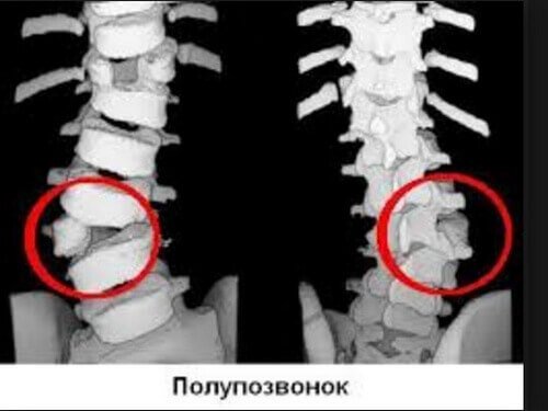 3 кращих методу діагностики поперекового остеохондрозу 30 3d3a0f6808038bb4e578fb88fbc66959
