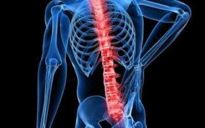Осколковий перелом хребта – механізм отримання, симптоматичні прояви травми, діагностика і способи лікування