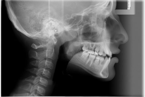 Відкритий перелом черепа: всі особливості травми