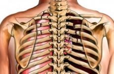 Перелом ребра: симптоми і лікування в домашніх умовах, реабілітація та ускладнення