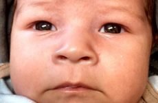 Вітамін Д немовляті: як давати і який вибрати